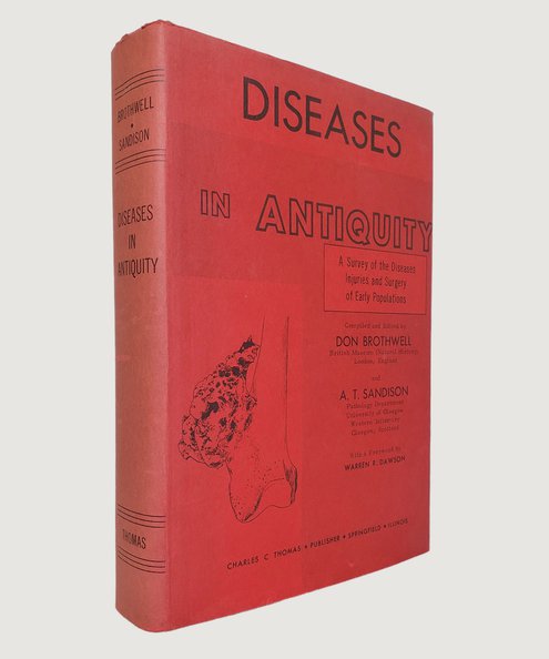  Diseases in Antiquity.  Brothwell, Don; Sandison, A. T. (editors)